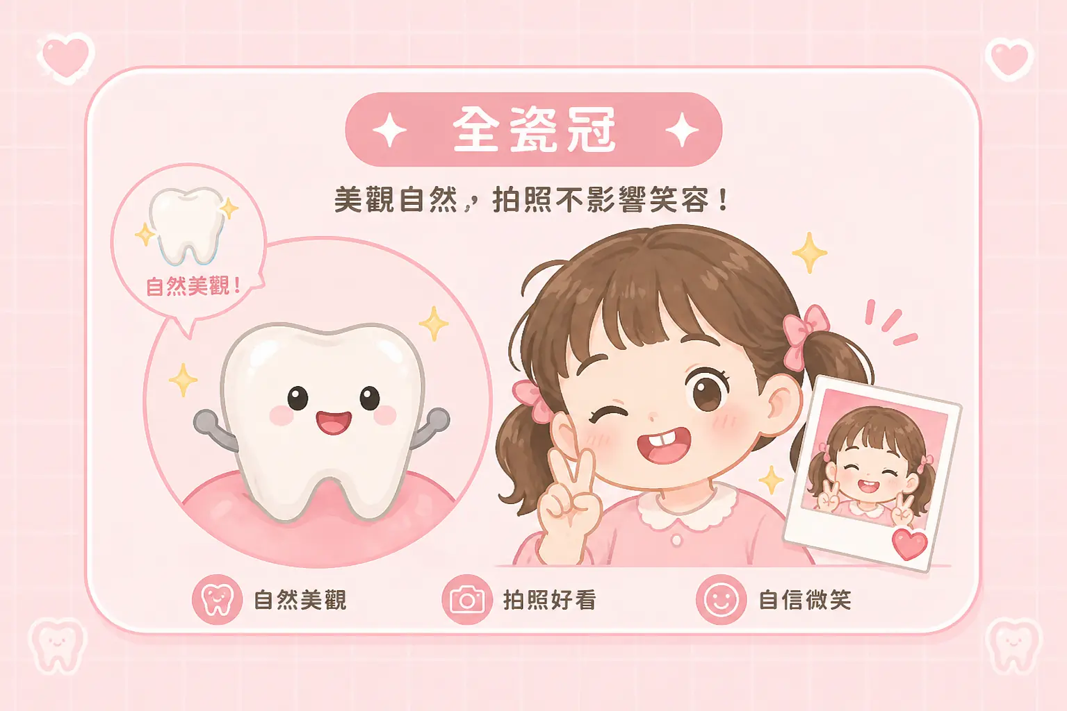前牙全瓷冠衛教插畫：兼顧外觀的乳牙牙套