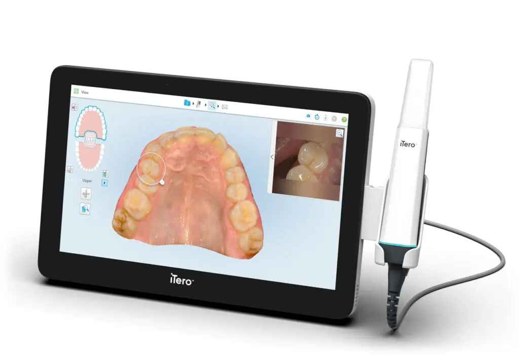 iTero 數位口掃機與螢幕上的 3D 齒列模型