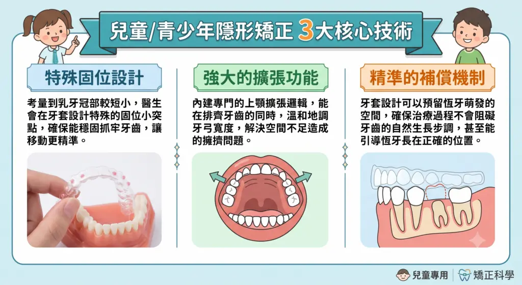 兒童與青少年隱形矯正的 3 項設計：固位、擴張與恆牙萌發空間