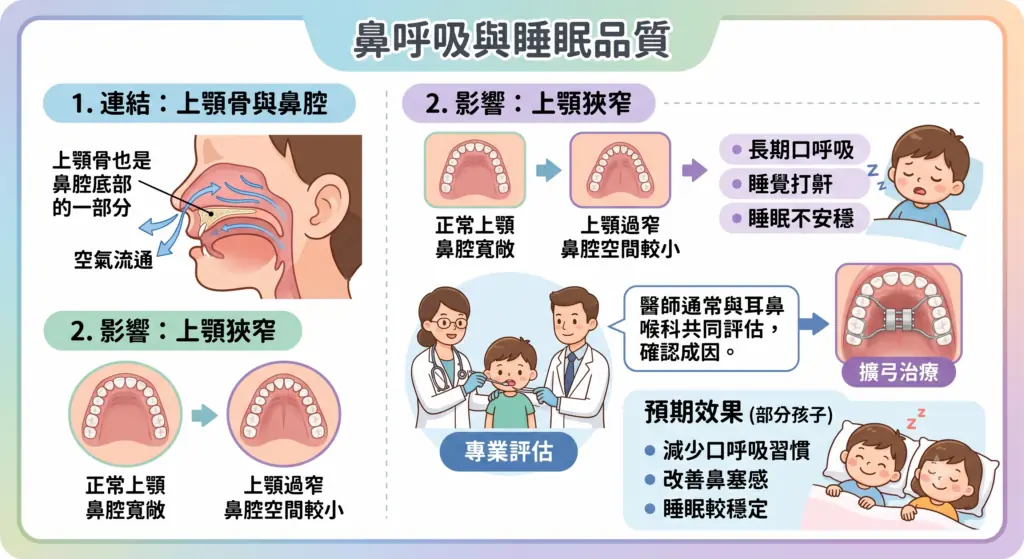 鼻呼吸與睡眠品質衛教圖：上顎狹窄與鼻腔空間的關係