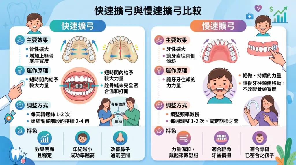 快速擴弓與慢速擴弓比較：作用方式、調整頻率與特色