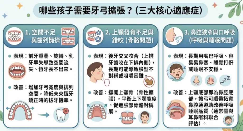哪些孩子需要牙弓擴張：空間不足、上顎發育不足與口呼吸三大情況