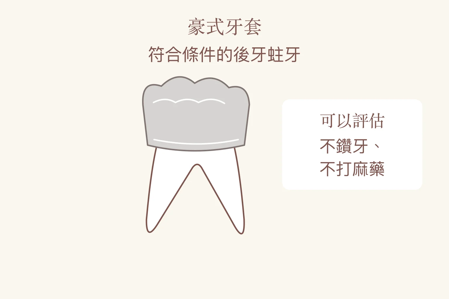 豪式乳牙牙套示意：符合條件的後牙蛀牙，可由醫師評估是否採用此方式。