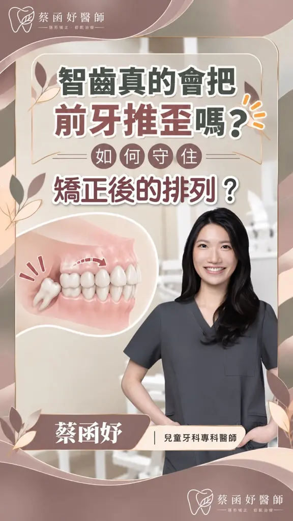 智齒會把前牙推歪嗎？矯正後怎麼維持排列短影音封面