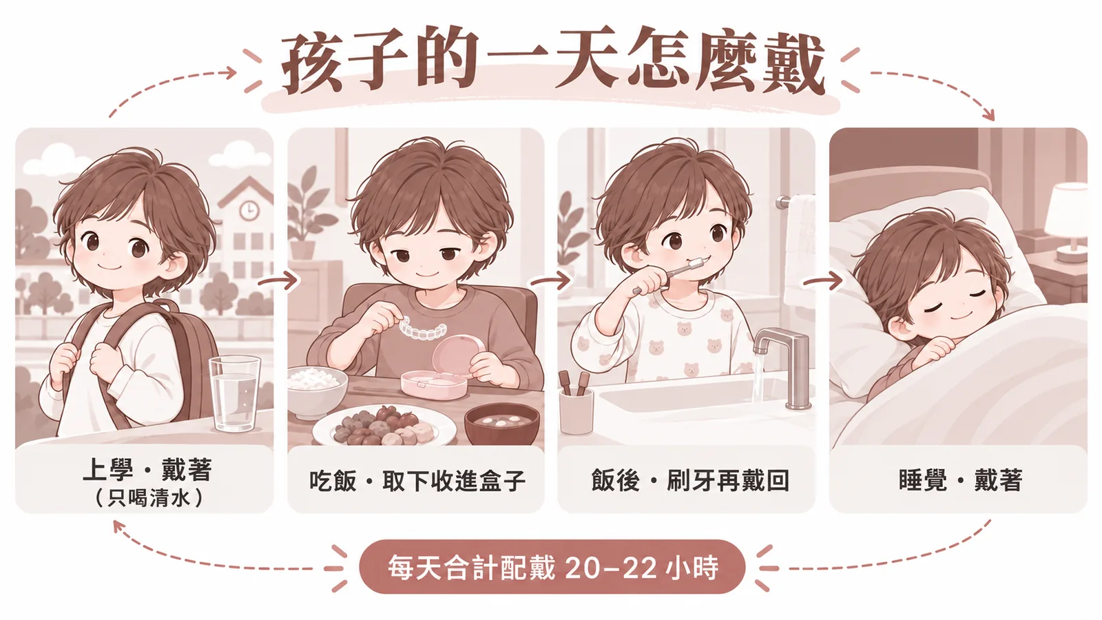 兒童隱適美一天配戴示意：上學戴著只喝清水、吃飯取下收進盒子、飯後刷牙再戴回、睡覺戴著