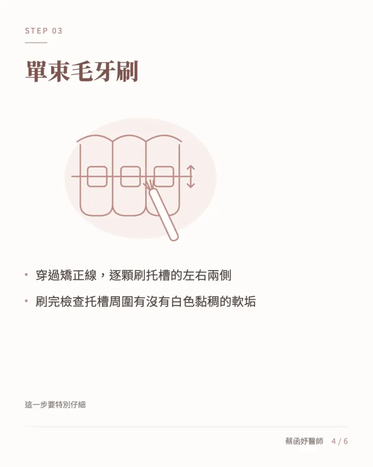 傳統矯正清潔第三步:用單束毛牙刷逐顆刷托槽左右兩側