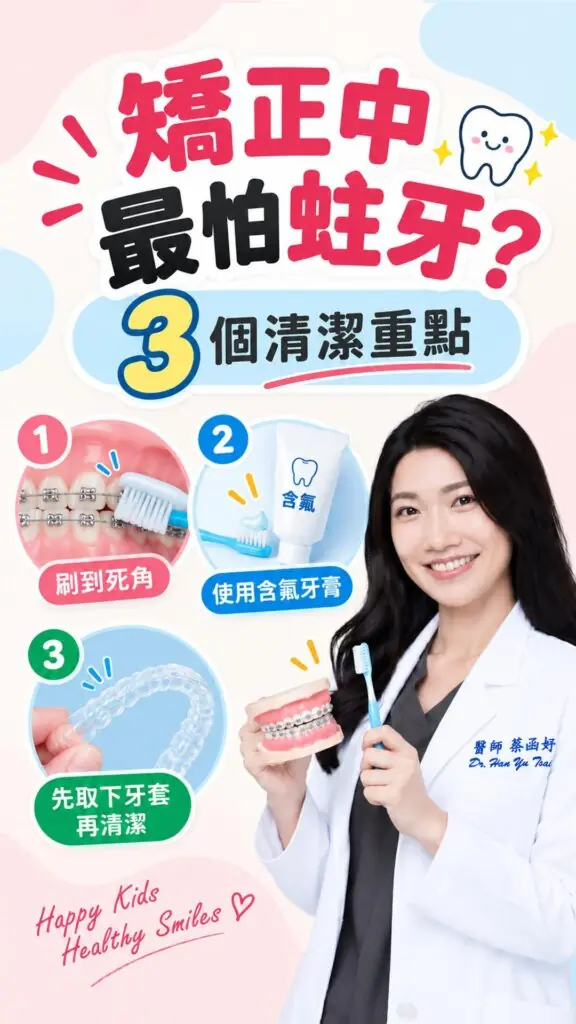矯正期間怕蛀牙？3 個清潔重點短影音封面